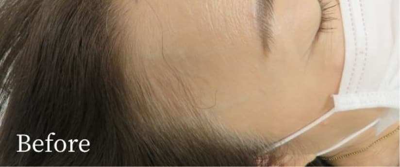 Before