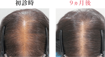 初診時 9ヵ月後