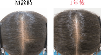 初診時 1年後